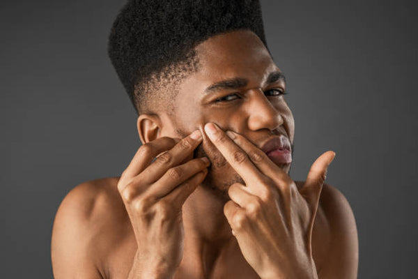 black man popping pimple