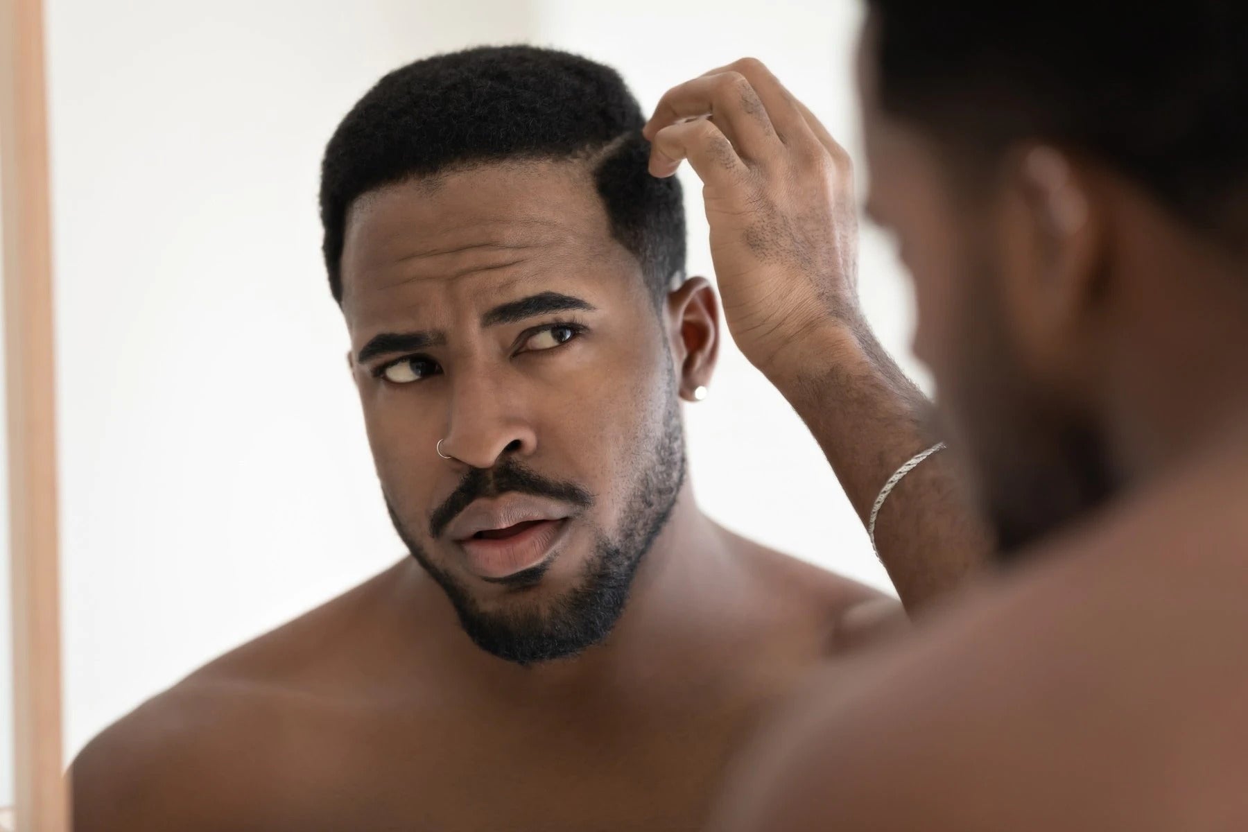 Why Do Black Men Have Dry Scalp Aaron Wallace
