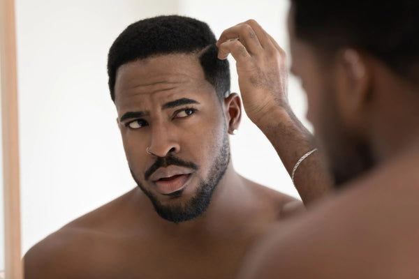 black man with dry scalp