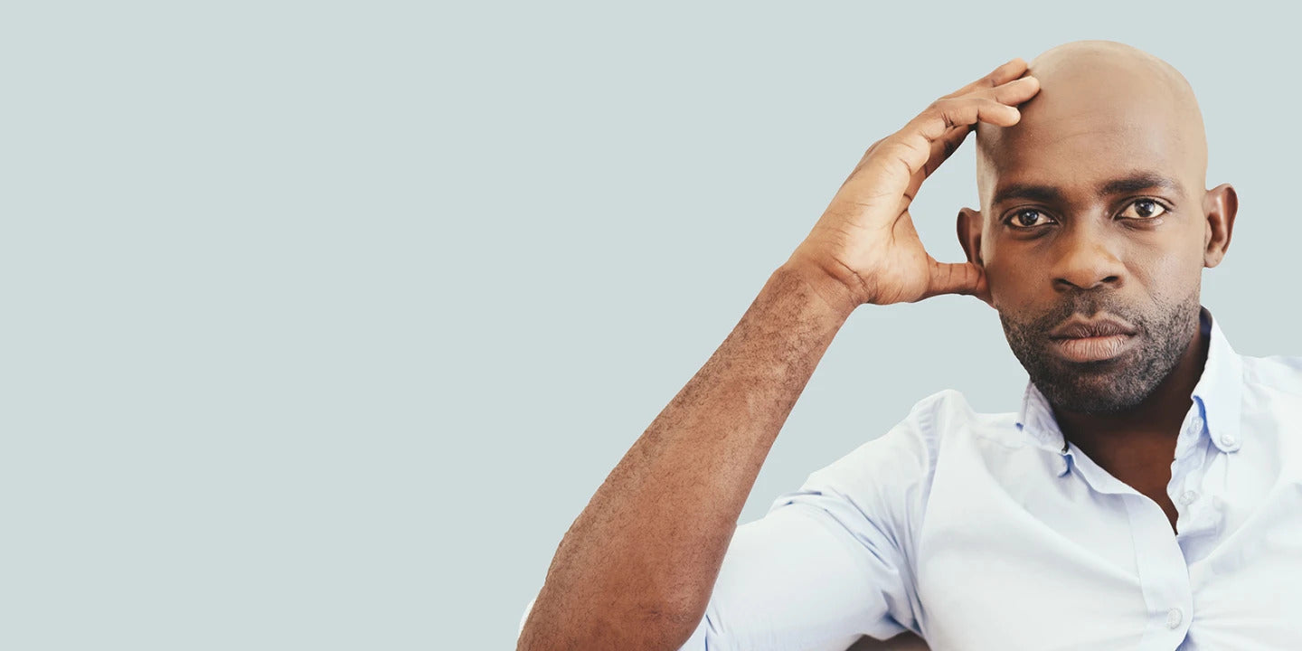 hair loss for black men