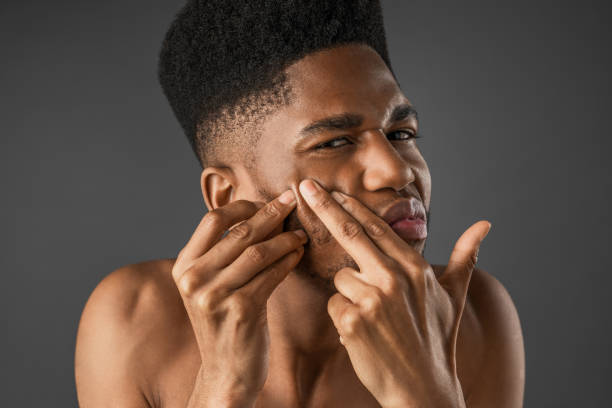 How Often Should You Exfoliate Your Face? | Fab.ng